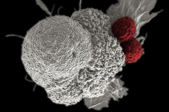 a tudomány szempontjából: rákos daganatok