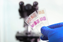 Rákdiagnosztika azonnal, a műtét közben – több mint 1,2 milliárd forintból fejleszthetnek az MTA TTK kutatói és innovációs partnereik