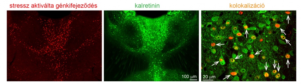 A stressz által kiváltott génkifejeződés (piros) kizárólag a kalretinintartalmú idegsejtekre (zöld) korlátozódik (fehér nyilak a nagyított képen, jobbra)