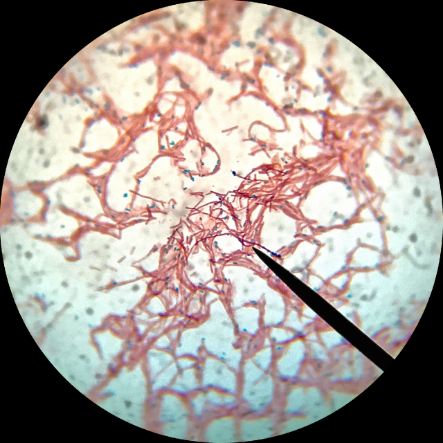 Bacillus subtilis spóraképződés közben