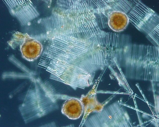Fitoplankton szervezetek: a kovamoszatok világos színűek, a nem kovamoszat szervezetek barnásak
